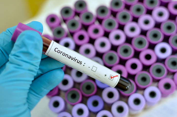 vials of blood being tested for Coronavirus